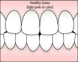 illustration of healthy gums