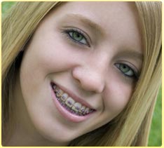 stock photo of a teen girl with braces